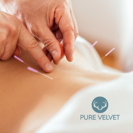 A woman uses deer antler velvet along with acupuncture to help relieve pain, immune system function and overall wellness.
